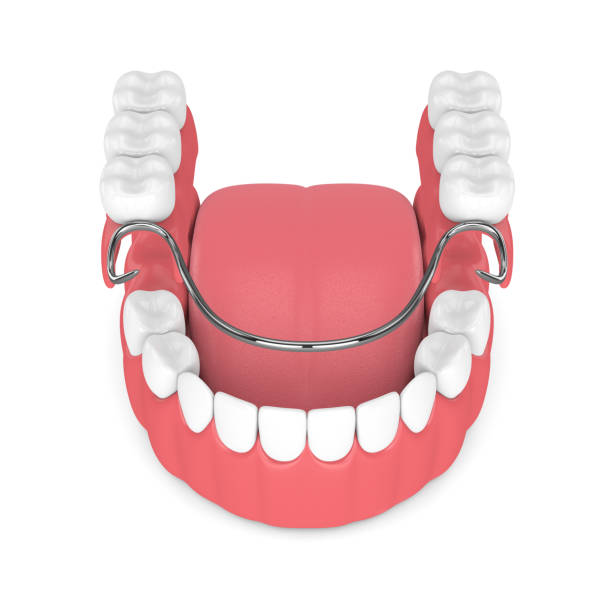 Partial Dentures 3d
